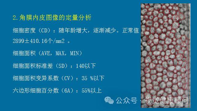 角膜内皮细胞计数报告，解读与临床应用